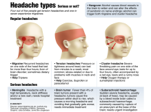 hovedpine, headache, visualisering, illustrationer, illustration, illustrere, tegning, tegner, præcision, naturalistisk, naturtro, digitale, digitaltegnede illustrationer, digital, vector, vektor, illustrator, grafisk, grafik, nyhedsgrafik, infografik, bøger, magasiner, hjemmesider, marketing, marketingsmateriale, artikler, årsrapport, teknisk dokumentation, 3D, perspektiv, kreativ, ideudvikling, 